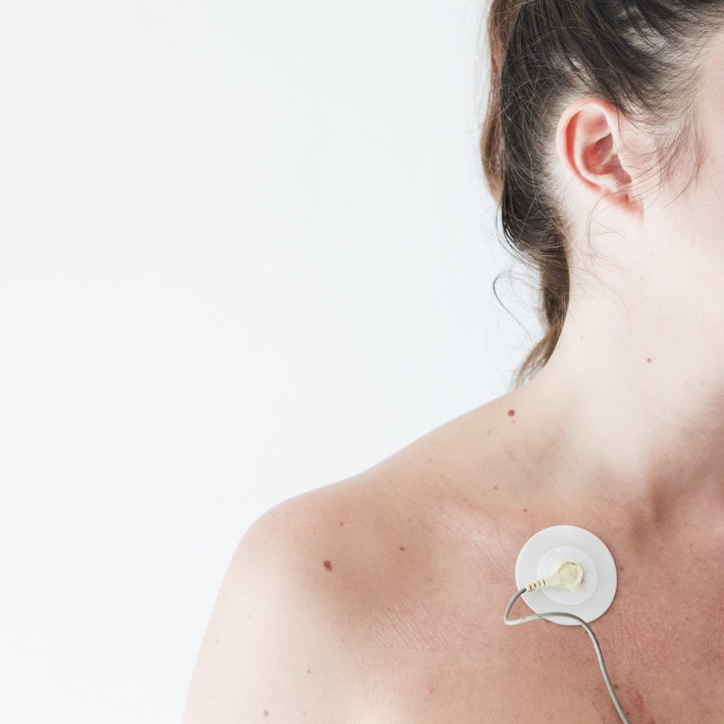 Skin Tag Removal